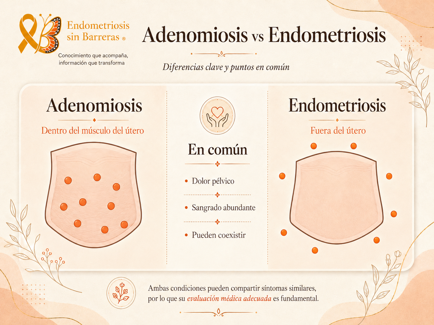 Adenomiosis vs Endometriosis: diferencias clave y puntos en común